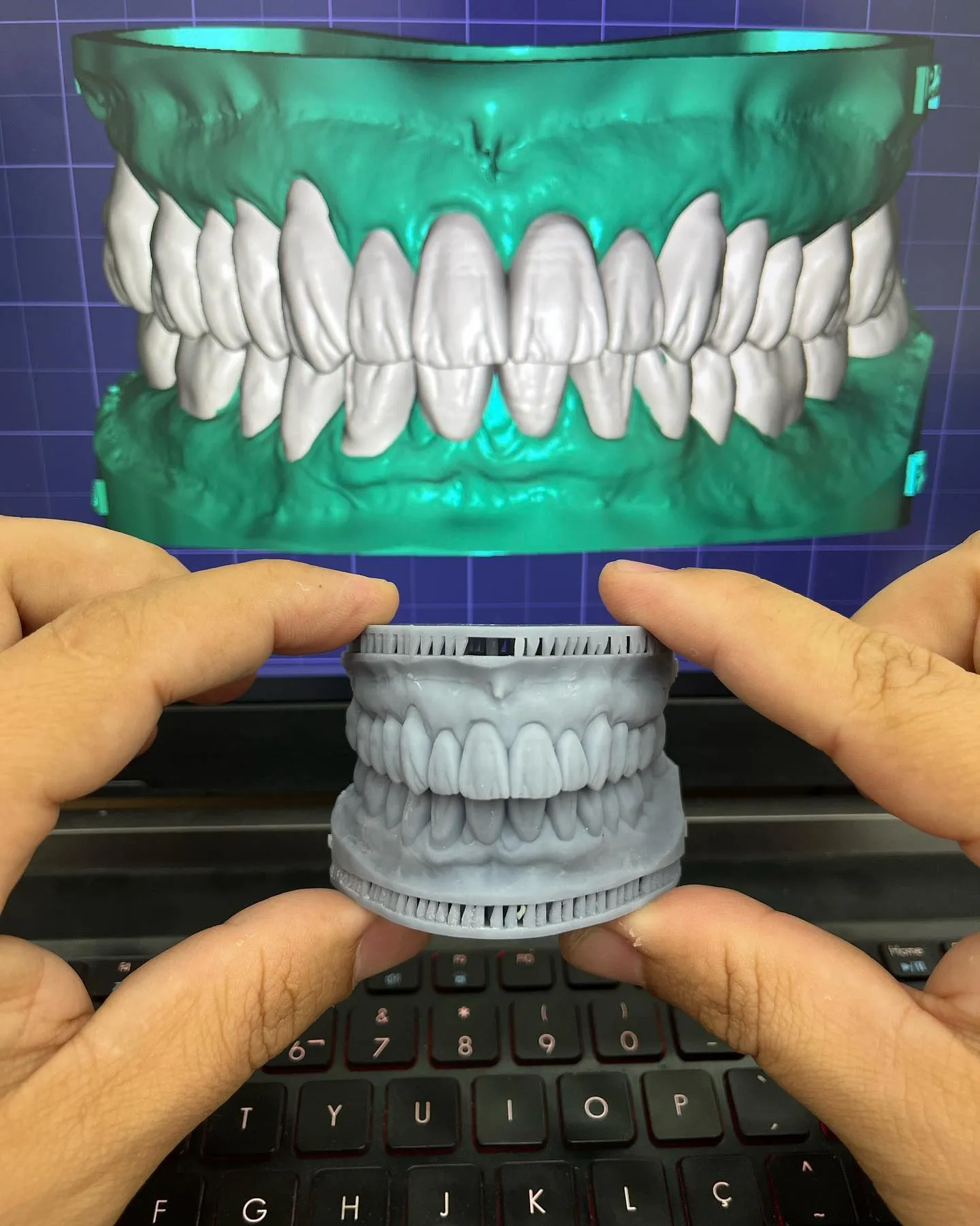 Planejamento 3D com modelo impresso